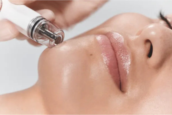 Diamond Glow facial